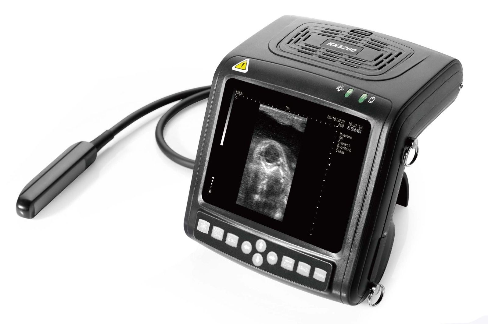 Цифровой ультразвуковой диагностический аппарат KX5200